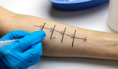 Skin Prick Allergy Panel Test